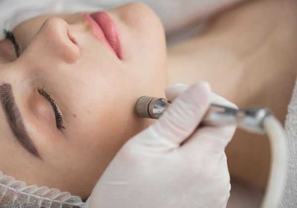 Dermabrasion